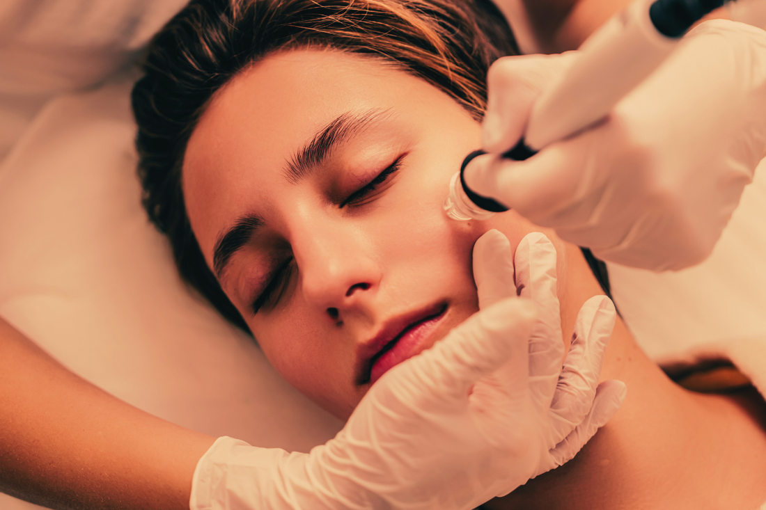 Get Radiant Skin With Hydro -Microdermabrasion